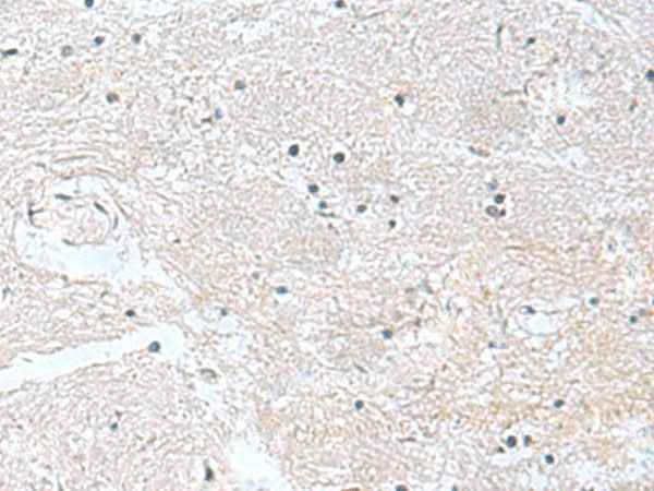 Anti-Human/Mouse/Rat CACNB1 Antibody