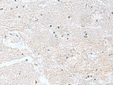 Immunohistochemistry of paraffin-embedded Human brain tissue using CACNB1 Polyclonal Antibody at dilution of 1:100(×200)
