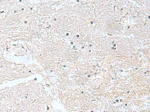 Anti-Human/Mouse/Rat CACNB1 Antibody