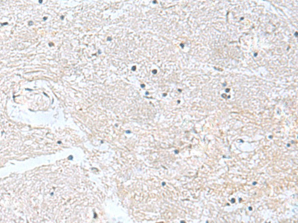 Immunohistochemistry of paraffin-embedded Human brain tissue using CACNB1 Polyclonal Antibody at dilution of 1:100(×200)
