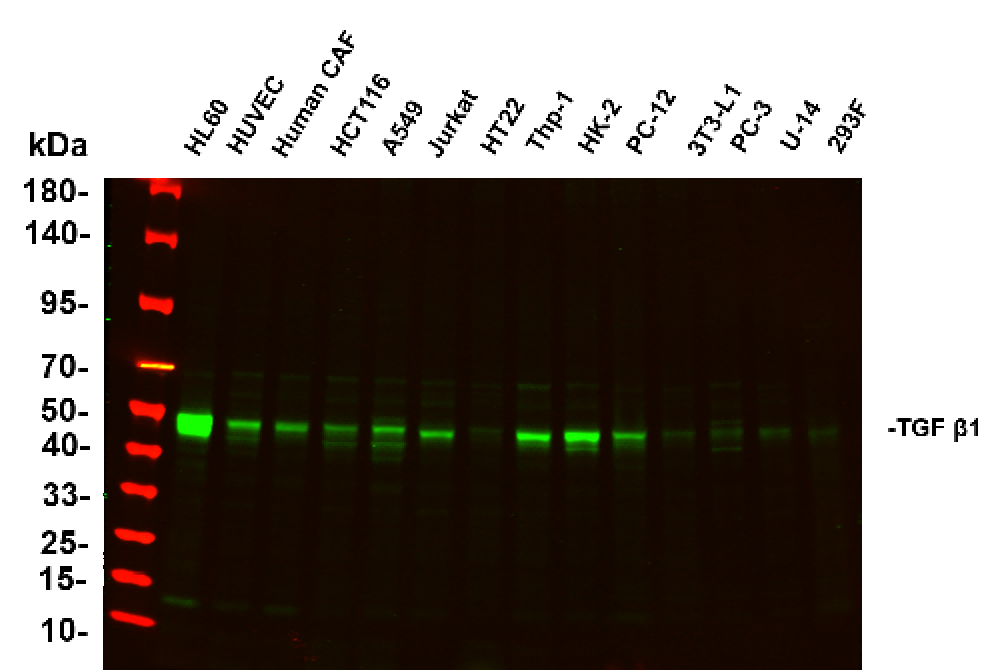 Anti-Human/Mouse/Rat TGF β1 Antibody [B888] - ABMIUM