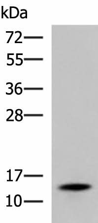 Western blot analysis of Mouse serum using TTR Polyclonal Antibody at dilution of 1:600