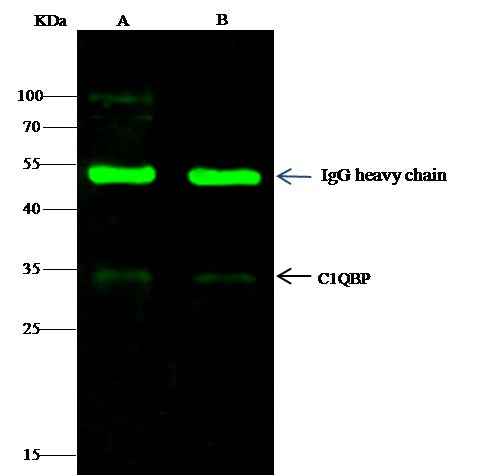 Anti-Mouse C1QBP Antibody [B422] - ABMIUM