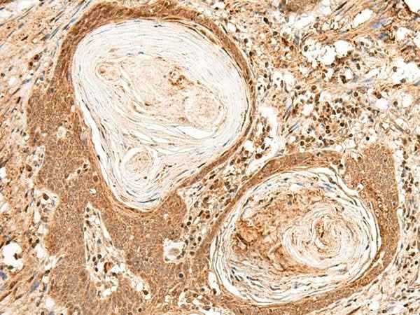 Anti-Human/Mouse FIZ1 Antibody