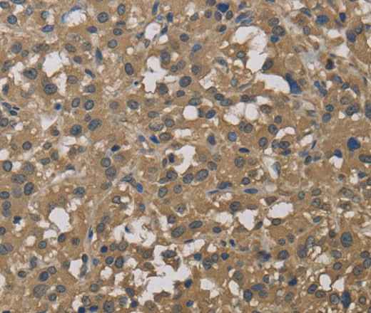 Anti-Human DCTN3 Antibody