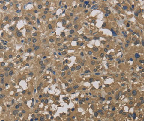 Anti-Human DCTN3 Antibody - ABMIUM