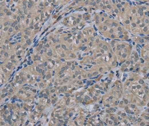 Anti-Human EDN1 Antibody