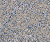Anti-Human EDN1 Antibody - ABMIUM
