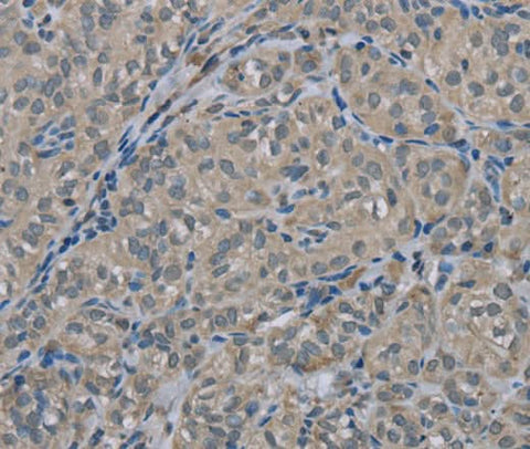 Anti-Human EDN1 Antibody - ABMIUM