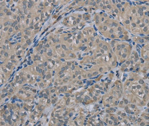 Anti-Human EDN1 Antibody - ABMIUM