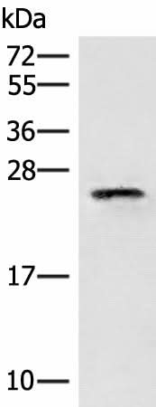 Western blot analysis of HT29 cell lysate using EIF3K Polyclonal Antibody at dilution of 1:400