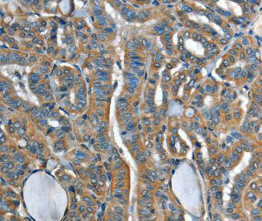 Anti-Human/Mouse/Rat ADCY4 Antibody
