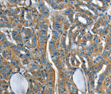 Anti-Human/Mouse/Rat ADCY4 Antibody - ABMIUM