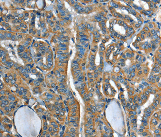 Anti-Human/Mouse/Rat ADCY4 Antibody - ABMIUM