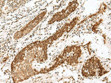 Anti-Human FANCB Antibody - ABMIUM