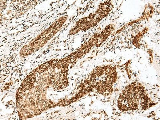 Anti-Human FANCB Antibody - ABMIUM