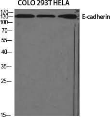 Western Blot analysis of various cells using E-cadherin Polyclonal Antibody at dilution of 1:1000.