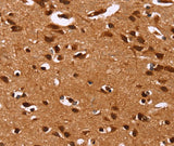 Anti-Human HRK Antibody - ABMIUM