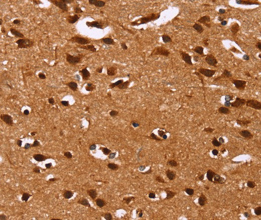 Anti-Human HRK Antibody - ABMIUM