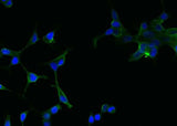 Anti-Human FOLH1 Antibody [A909] - ABMIUM