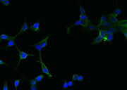 Anti-Human FOLH1 Antibody [A909] - ABMIUM