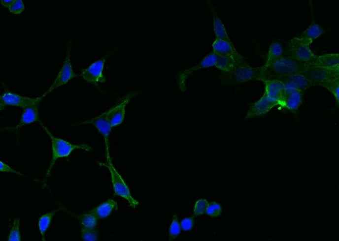 Anti-Human FOLH1 Antibody [A909] - ABMIUM