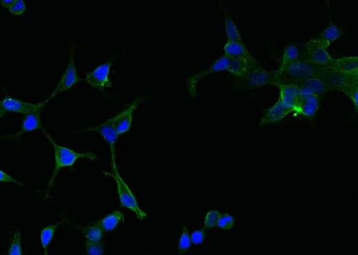Anti-Human FOLH1 Antibody [A909] - ABMIUM