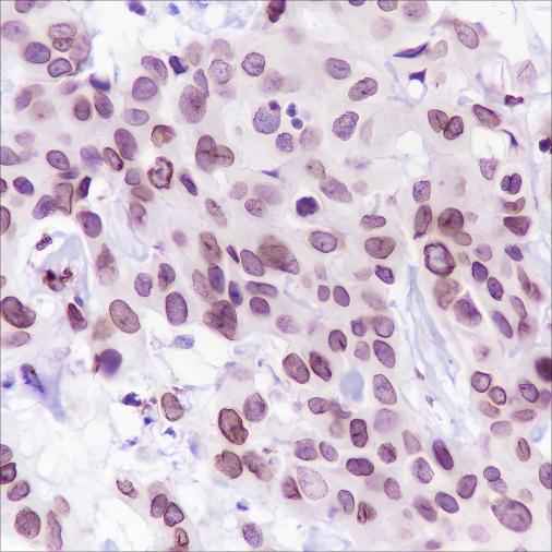 Anti-Human FBXW7 Antibody [A220] - ABMIUM