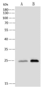 Anti-Human CSF3 Antibody [A878] - ABMIUM