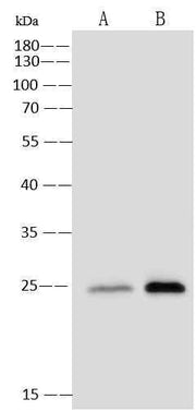 Anti-Human CSF3 Antibody [A878] - ABMIUM