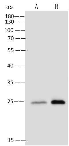 Anti-Human CSF3 Antibody [A878] - ABMIUM
