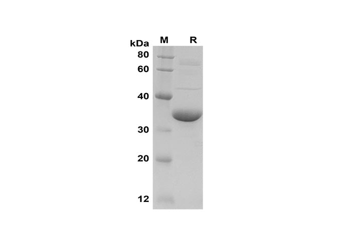 SDS-PAGE analysis of Human HIF-1α proteins, 2 μg/lane of Recombinant Human HIF-1α proteins was resolved with SDS-PAGE under reducing conditions, showing bands at 35 kDa.