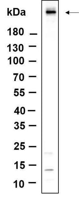 Anti-Human/Mouse/Rat Atm Antibody [B894]