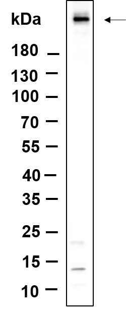 Anti-Human/Mouse/Rat Atm Antibody [B894] - ABMIUM