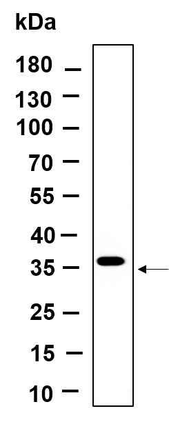 Anti-Human/Mouse/Rat BSND Antibody [B992] - ABMIUM