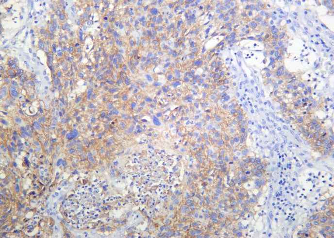 Anti-Human/Mouse/Rat RSK3 Antibody [B1008] - ABMIUM