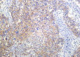 Anti-Human/Mouse/Rat RSK3 Antibody [B1008]