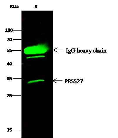 Anti-Human PRSS27 Antibody [A1214] - ABMIUM