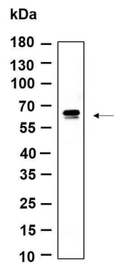 Anti-Human/Mouse/Rat PDE1B Antibody [B989]