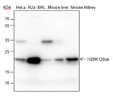 Anti-Human/Rat/Mouse Histone H2B Antibody [A831] - ABMIUM