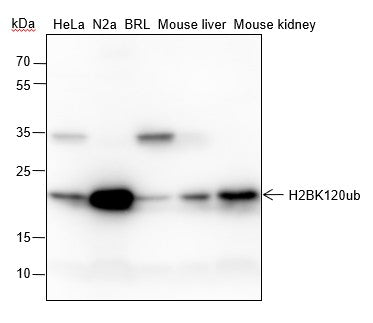 Anti-Human/Rat/Mouse Histone H2B Antibody [A831] - ABMIUM