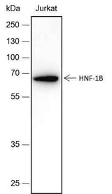 Anti-Human/Rat/Mouse HNF-1B Antibody [A434]