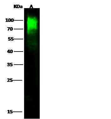 Anti-Mouse CDH5 Antibody [B421] - ABMIUM