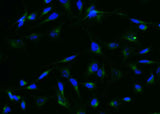 Anti-Human GRN Antibody [A1038] - ABMIUM