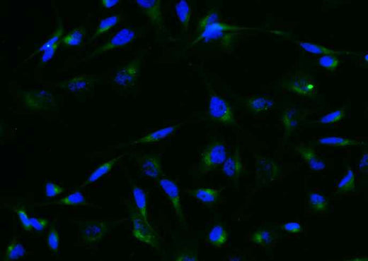 Anti-Human GRN Antibody [A1038] - ABMIUM
