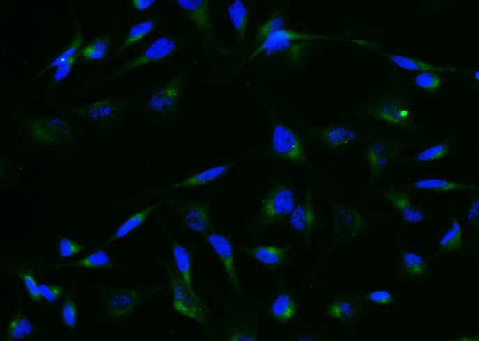 Anti-Human GRN Antibody [A1038] - ABMIUM