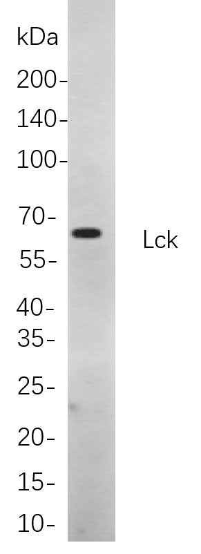 Anti-Human/Mouse/Rat Lck Antibody [B889] - ABMIUM