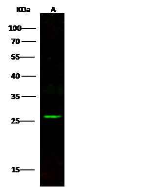 Anti-Human BCL2 Antibody [A1141] - ABMIUM