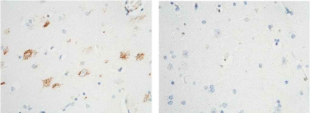Anti-Human NTRK1 Antibody [B136] - ABMIUM