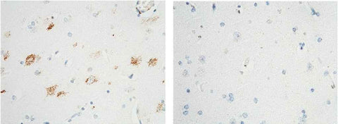 Anti-Human NTRK1 Antibody [B136] - ABMIUM